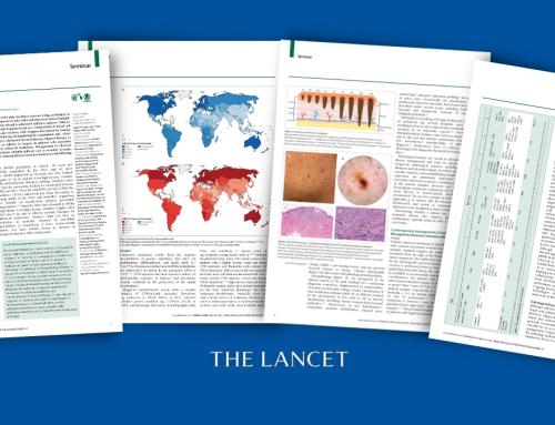 Cutaneous melanoma: a contemporary overview published in The Lancet