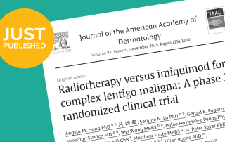 radiotherapy_v_Imiquimod