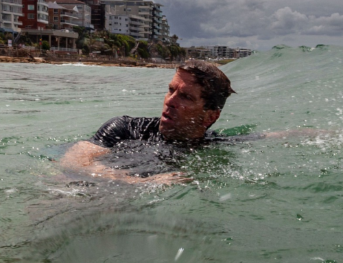 UV exposure leading cause of preventable cancers for Australian men