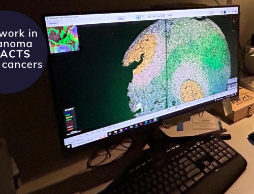Location and type of immune cells affects treatment response